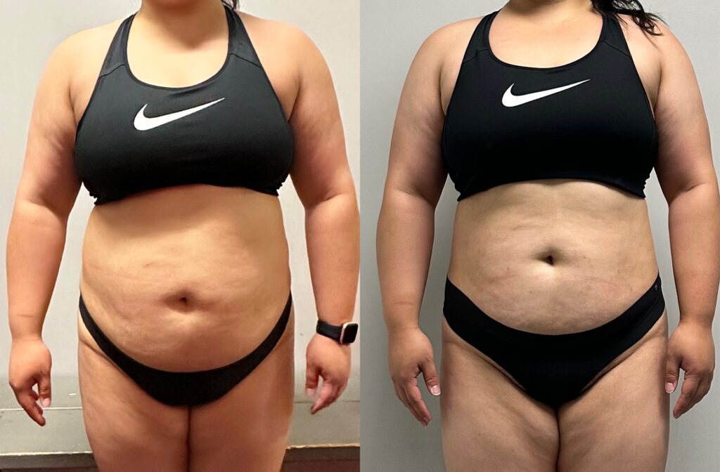 Front-facing before and after photos of a fitness client's progress on their fitness journey