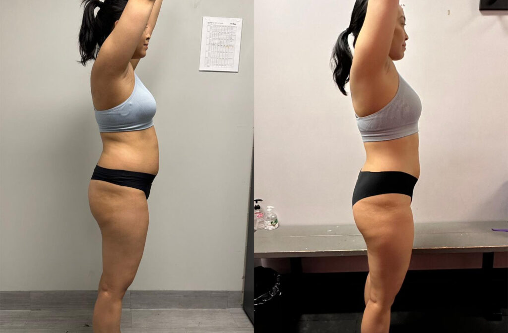 Side view before and after photos of a fitness client's progress on their fitness journey